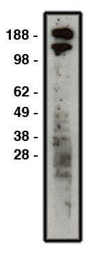 "
Western blot using ROBO1 antibody (Cat. No. X2313P) on HT-29 cell lysate.  Lysate used at 30 µg/lane.  Antibody used at 1:400 dilution.  Secondary antibody, mouse anti-rabbit HRP (Cat. No. X1207M), used at 1:50k dilution."